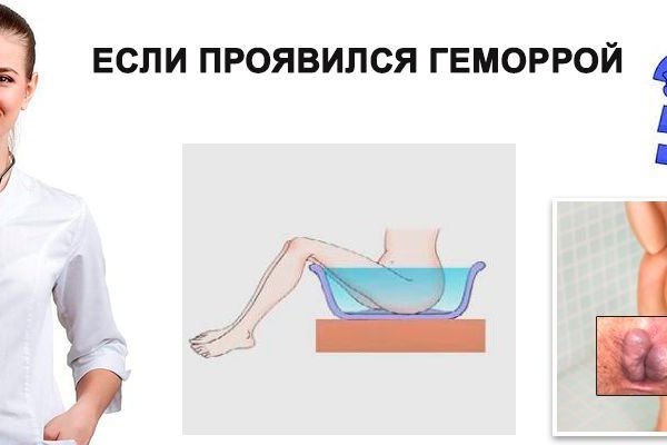 Кракен маркетплейс что